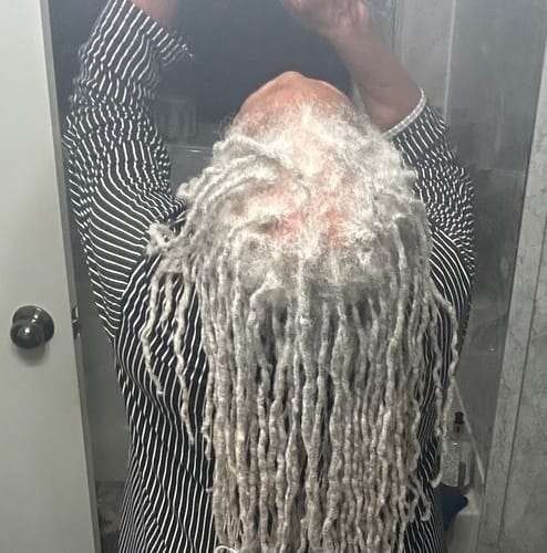 Reviewer shows a thinning crown with visible scalp before using the Rennora Hair Growth Serum.