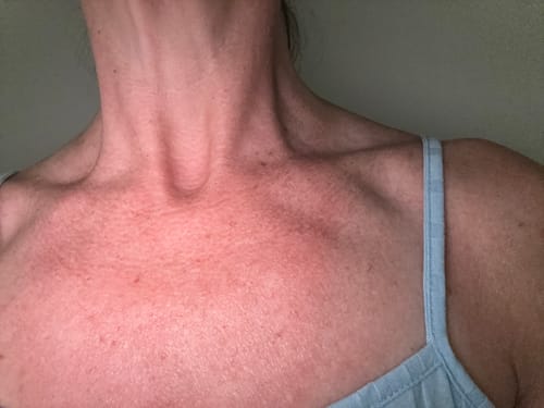 Customer photo review of The Daily Remedy