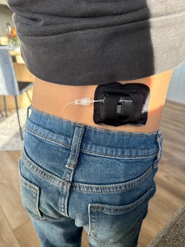 Customer photo review of Skin Grip - Tandem Mobi Pocket Patch