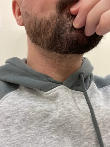 Customer photo review of Seb Natural Calming Serum
