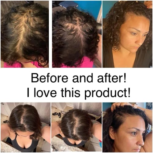 Customer photo review of Rosemary Biotin Growth Shampoo