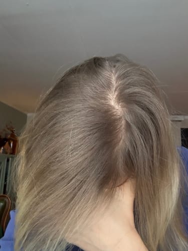 Customer photo review of Sunkissed Starter Kit