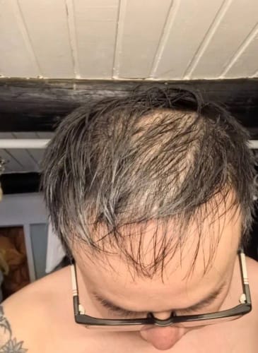 Customer photo review of Rosemary Biotin Growth Shampoo