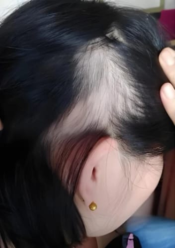 Customer photo review of Rosemary Biotin Growth Shampoo