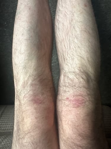 Customer photo review of Seb Natural Soothing Balm