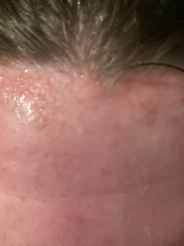Customer photo review of Seb Natural Calming Serum