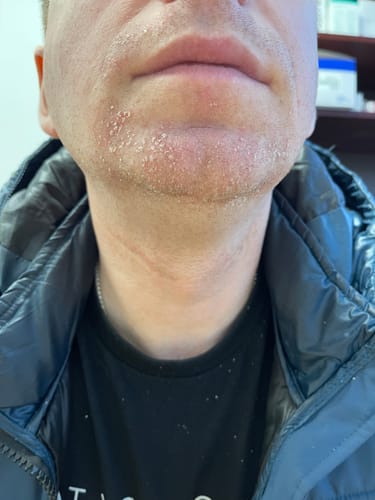Customer photo review of Seb Natural Calming Serum