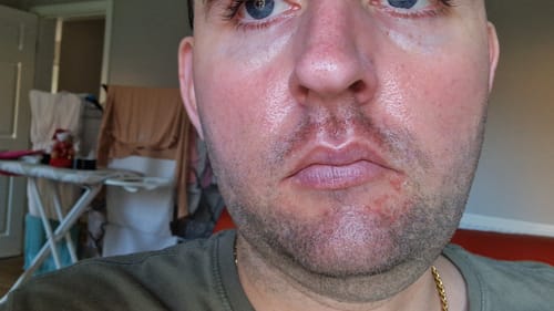 Customer photo review of Seb Natural Calming Serum