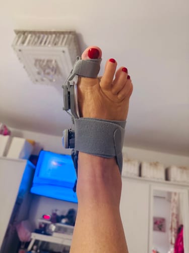 Értékelő lábán a szürke Ortolin bütyökvédő sín használat közben.