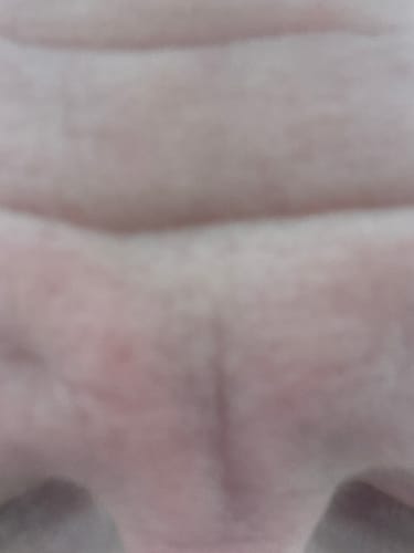 Customer photo review of Seb Natural Calming Serum