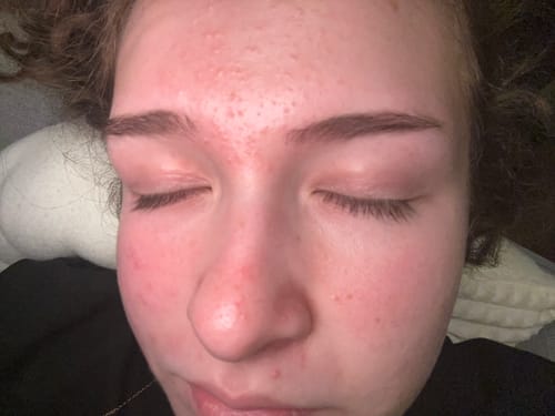 Customer photo review of KosmaLash® | Sérum Crecimiento & Anticaída