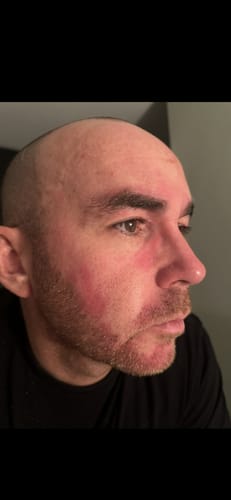 Customer photo review of Seb Natural Calming Serum