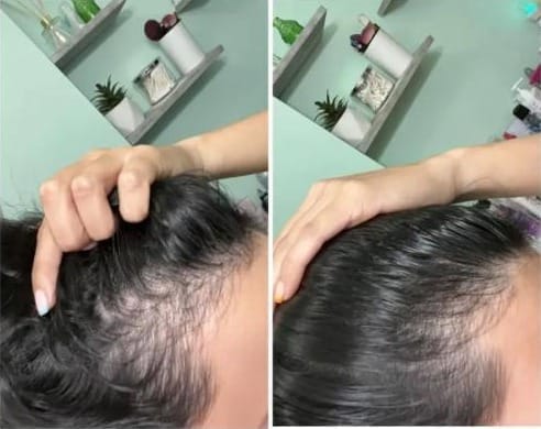Customer photo review of BloomOil - Natürliches Haar Öl