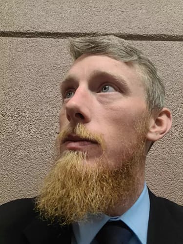 Customer photo review of ReBeard רולר לצמיחת זקן