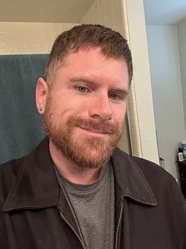Customer photo review of ReBeard רולר לצמיחת זקן