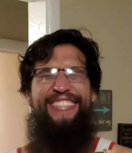 Customer photo review of ReBeard רולר לצמיחת זקן