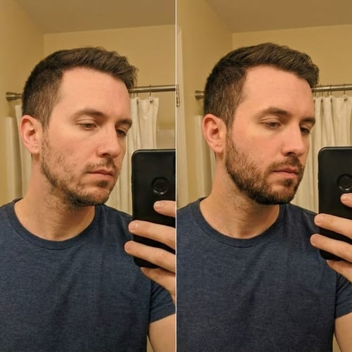 Customer photo review of ReBeard רולר לצמיחת זקן