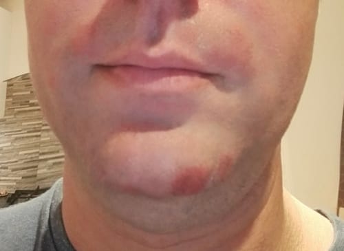 Customer photo review of Seb Natural Calming Serum