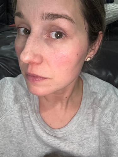 Reviewer's glowing face after using Grass Fed Tallow & Honey Balm, showing skin with reduced redness.