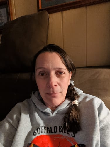 Reviewer showing her face after using The Micro Infusion System.