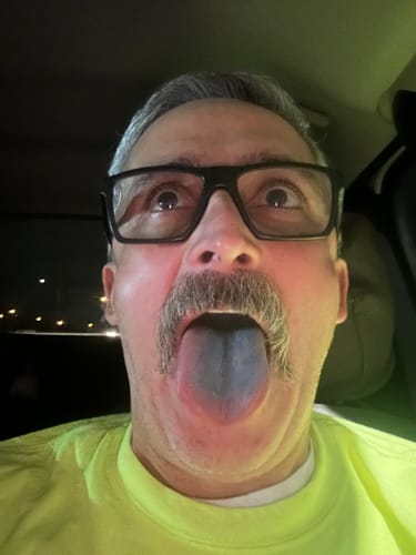 Customer sticking out their tongue to show it stained blue from using Meraki Blu Methylene Blue.