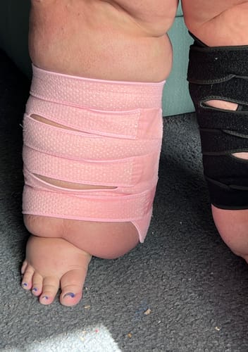 Customer photo review of Beltwell® Calf Compression Wrap