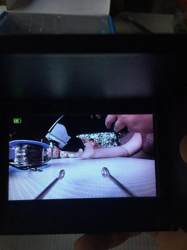 Customer photo review of Aurisle Underwater Fishing Camera (Real-Time View, No App Needed)