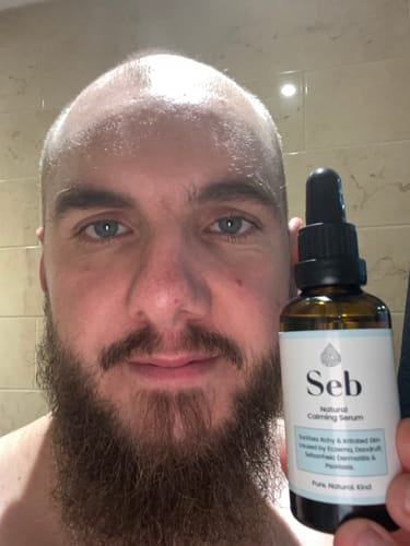 Customer photo review of Seb Natural Calming Serum