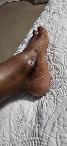 Customer photo review of Sweet Ginger Vapor Rub Stick