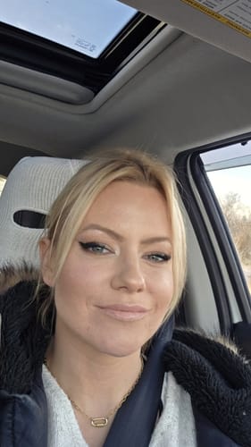 Customer showing smooth, even-toned skin after using The Micro Infusion System.