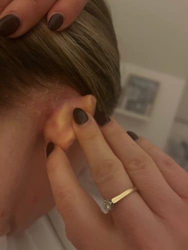 Customer photo review of Seb Natural Calming Serum
