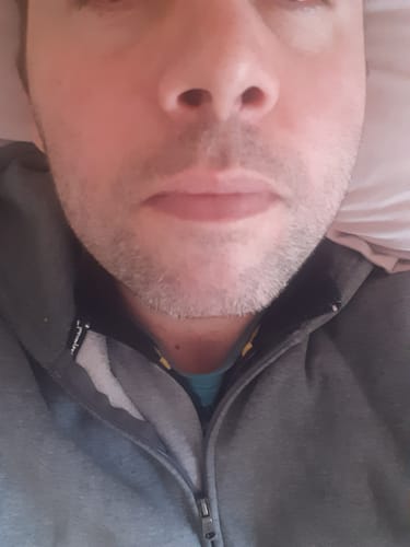 Customer photo review of Seb Natural Calming Serum