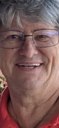 Reviewer's face before using the Seranova Micro Infusion System, showing visible wrinkles around the mouth and eyes.