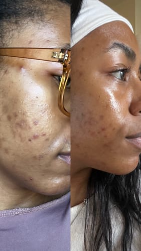 Customer photo review of See Spot Run | Face Mask