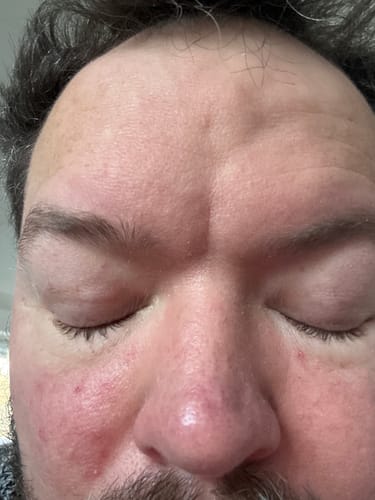 Customer photo review of Seb Natural Calming Serum