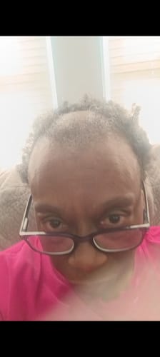 Reviewer shows a close-up of their thinning hair and edges, treated with Miracle Chebe Butter.