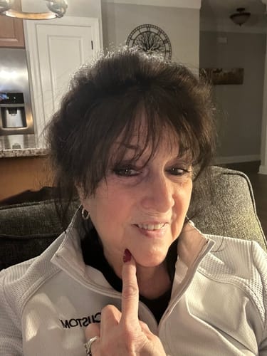 Reviewer points to her chin area, showing reduced lines after using the Seranova Micro Infusion System.