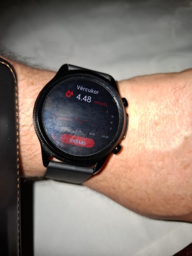 A vásárló csuklóján egy fekete okosóra látható, amely a 4,48-as vércukorszintet mutatja.