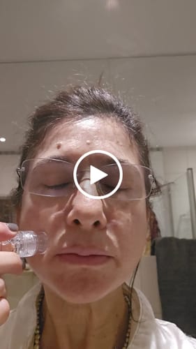 Customer video review of The Micro Infusion System™