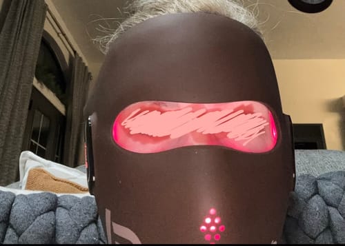 Customer photo review of JOVS 4D Laser Anti-Aging Therapy Mask