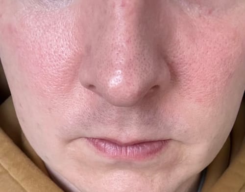 Customer photo review of Seb Natural Calming Serum