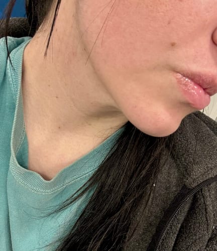 Customer photo review of INIA HAUTE Pro IPL Hair Removal Device