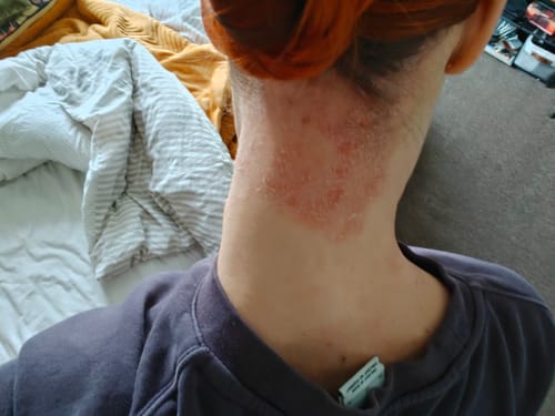 Customer photo review of Seb Natural Soothing Balm