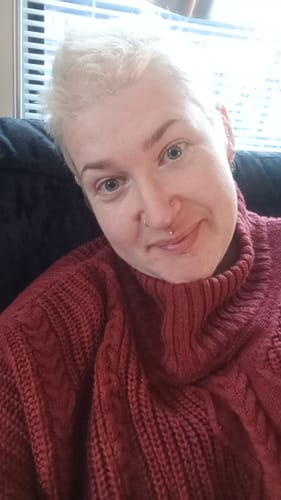 Customer photo review of Seb Natural Calming Serum