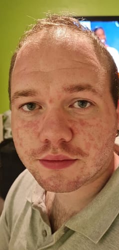 Customer photo review of Seb Natural Calming Serum