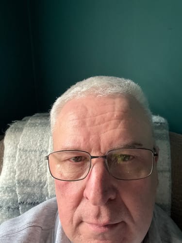 Customer photo review of Seb Natural Calming Serum