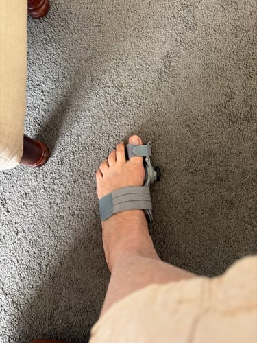 Customer's foot wearing the grey Treatmedy Bunion Fix support device on a carpeted floor.