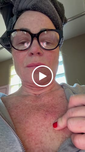 Customer video review of 3 Month Supply - Seranova Micro Infusion System