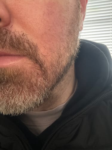 Customer photo review of Seb Natural Calming Serum