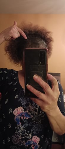 Reviewer pointing to their scalp, showing the thinning crown area discussed in their review of the hair balm.